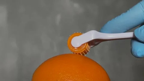 Cosmetic Derma Roller rolling over an orange – Skincare Concept. Dermaroller Stock Footage 303022057