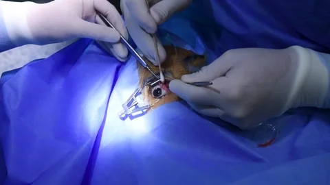 Cosmetic eye surgery Video stock 146288632