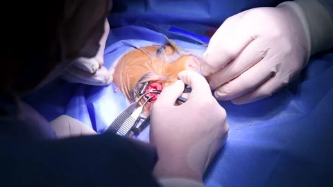 Cosmetic eye surgery Stock Footage 146288904