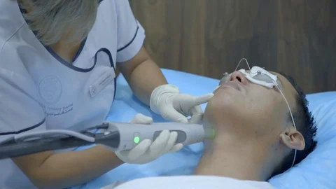 Cosmetic Laser Procedure Video stock 97864716
