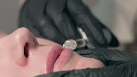 Cosmetic Procedure Lip Enhancement using Injection Treatment for a more Stock-Footage 313292019