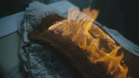 Cosmetic procedure performed with fire Stock Footage 76997331