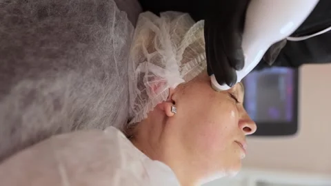 Cosmetic procedure SMAS facelift is done on an elderly woman. close-up. Stock Footage 264161053