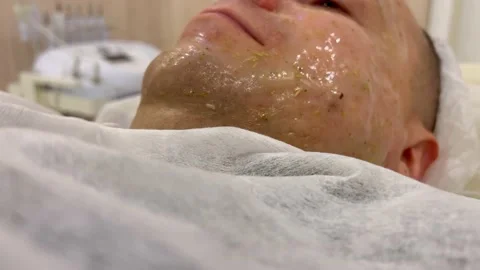 Cosmetic procedures on a man's face Stock Footage 212474784
