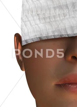 Cosmetic surgery, conceptual artwork Stock Illustration