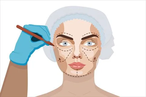 Cosmetic Surgery Face Marking. Stock Illustration