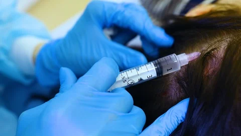 Cosmetic surgery performs a procedure for hair regeneration by mesotherapy Stock Footage 126031153