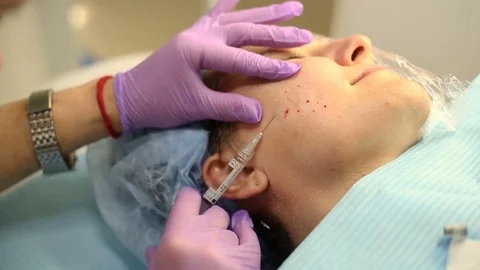 Cosmetician using a needle and doing shots to client's face Stock Footage 76187989