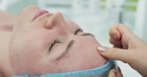 Cosmetological procedure Stock Footage 153404235