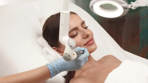 Cosmetologist arm using erbium laser on woman face Video stock 143162040