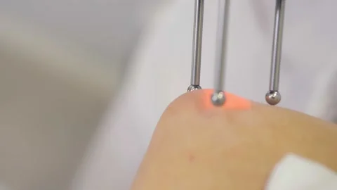 Cosmetologist dermatologist performs hardware laser hair removal to a patient in Stock Footage 169076744