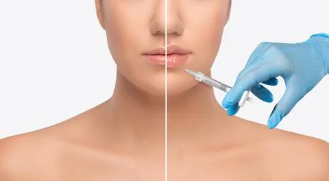 Cosmetologist does injections for lips augmentation of a beautiful woman. Wom Stock Photos