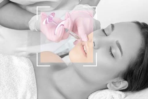 Cosmetologist does injections for lips augmentation and anti wrinkle in the.. Stock Photos