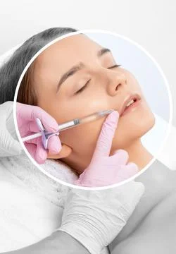 Cosmetologist does injections for lips augmentation and anti wrinkle in the.. Foto stock