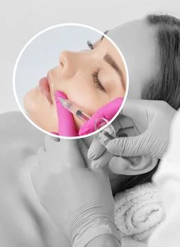 Cosmetologist does injections for lips augmentation and anti wrinkle in the.. Stock Photos