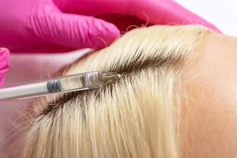 Cosmetologist does injections therapy against hair loss and anti-dandruff of  Stock Photos