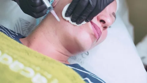 Cosmetologist in gloves making face injection in a female skin Stock Footage 95984114
