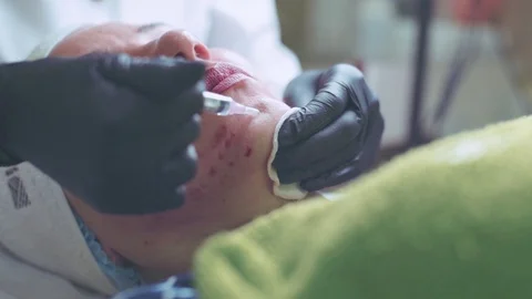 Cosmetologist in gloves making face injection in a female skin Stock Footage 95984118