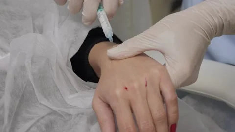 The cosmetologist inserts an injection into the palm of the patient. Stock Footage 145466277