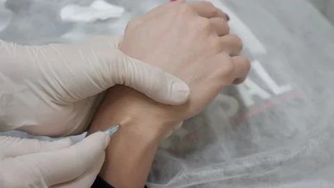 The cosmetologist inserts an injection into the palm of the patient. Vídeos de archivo 147142560