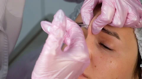 Cosmetologist makes injection of botulinum in woman's skin between the eyebrows. Stock Footage 146366052