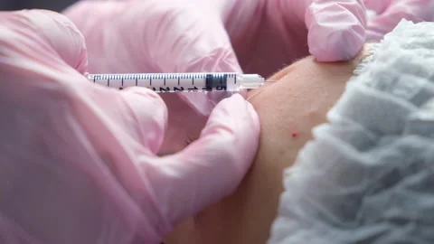 Cosmetologist makes injection of botulinum in woman's forehead, side view. Stock Footage 146366710