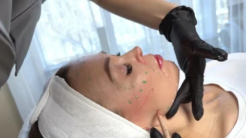 The cosmetologist makes markings on the patient face before injections Stock Footage 301005481