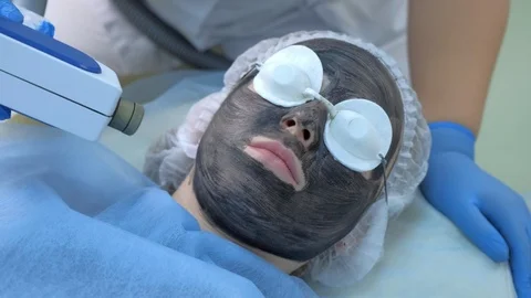 Cosmetologist making laser carbon face peeling procedure to woman on face skin. Video stock 124954680