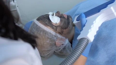 Cosmetologist making laser carbon face peeling procedure to woman on face skin. Vídeo Stock 124955252