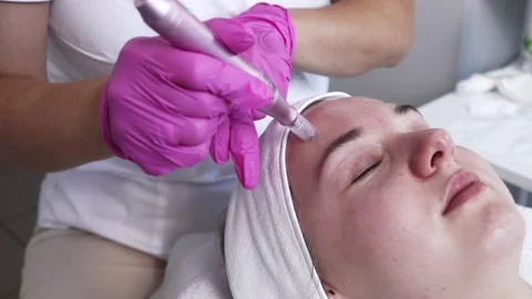 Cosmetologist Making Mesotherapy Injection With Dermapen On Face, Cheek Area Of Stock Footage 256921446