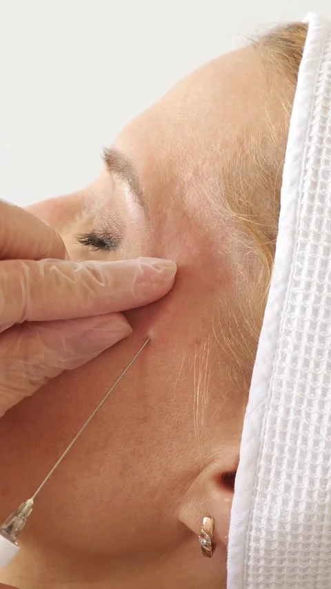 Cosmetologist performing thread lifting procedure on a womans face in a beauty Stockbeeldmateriaal 341446859