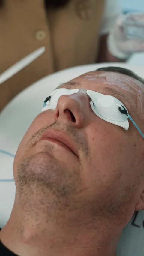 A cosmetologist performs a deep skin cleansing procedure on a senior man Stock Footage 303444164