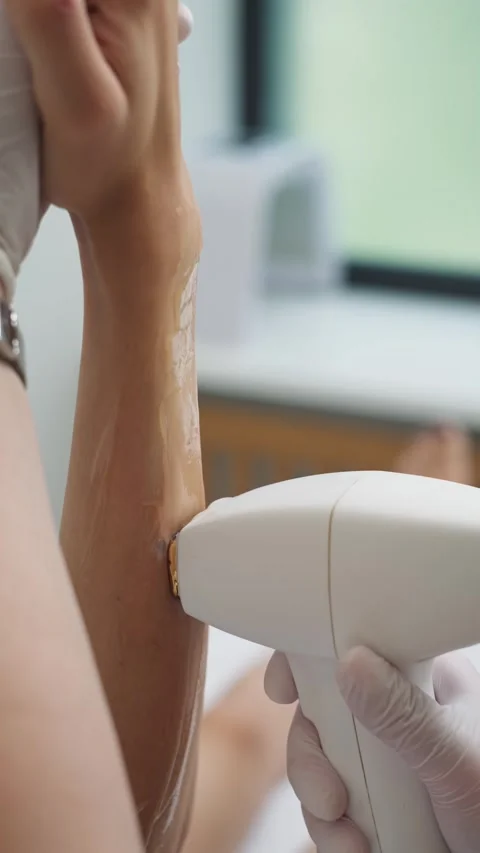 Cosmetologist performs a laser depilation procedure on a woman hand Stock Footage 307068426