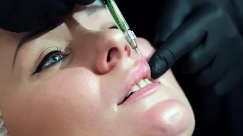 A cosmetologist performs a lip augmentation procedure in a beauty salon Stock Footage 264684626
