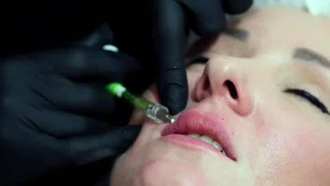 A cosmetologist performs a lip augmentation procedure in a beauty salon Stockbeeldmateriaal 264685124