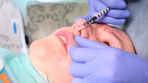 The cosmetologist performs a procedure to increase the lips of a woman in a Foto stock