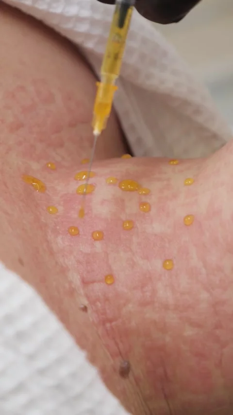 Cosmetologist performs RF lifting procedure Stock Footage 274095533