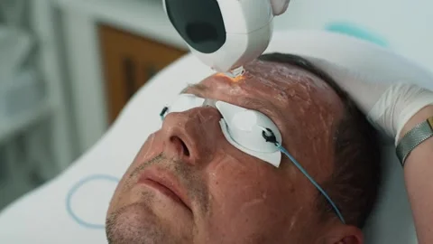A cosmetologist performs a skin cleansing procedure on a man. Stock Footage 307069684