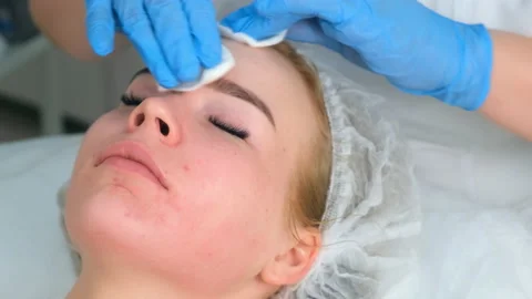 Cosmetologist is wiping woman's face after plasmalifting procedure, closeup. Stock Footage 145122853