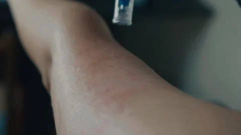 Cosmetologist's hands in black gloves using Meso Pen on patient's skin. Stock Footage 287156894