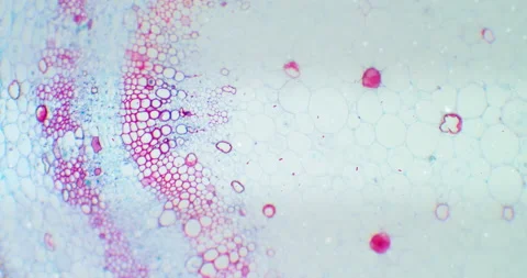 Cotton stem under a microscope with a focus on germs, microbes and bacteria Stock Footage 189529595