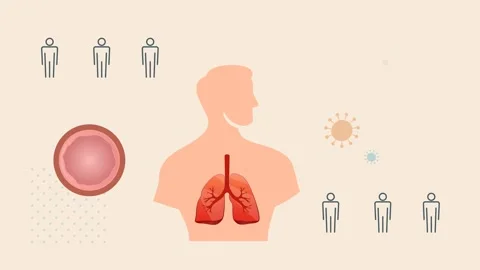 Cough and Breathing Difficulty - COPD Care - Animated Illustration Stock Footage 332236164