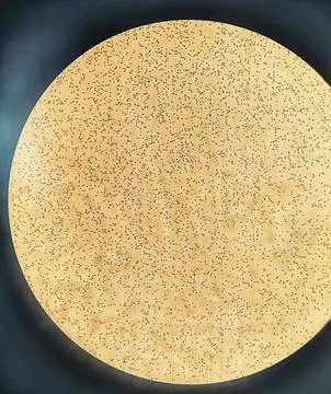 Counting erythrocytes using a hemocytometer. Foto stock