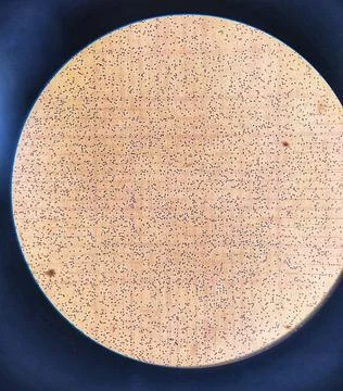Counting erythrocytes using a hemocytometer. Stock Photos