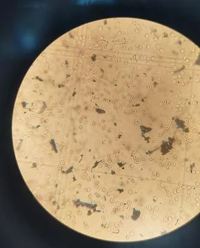 Counting erythrocytes using a hemocytometer. Stock Photos