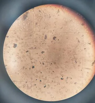 Counting erythrocytes using a hemocytometer. Stock Photos
