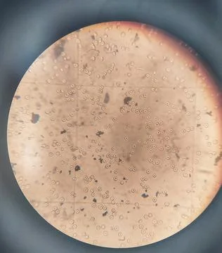 Counting erythrocytes using a hemocytometer. Stock Photos
