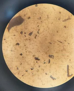 Counting erythrocytes using a hemocytometer. Stock Photos