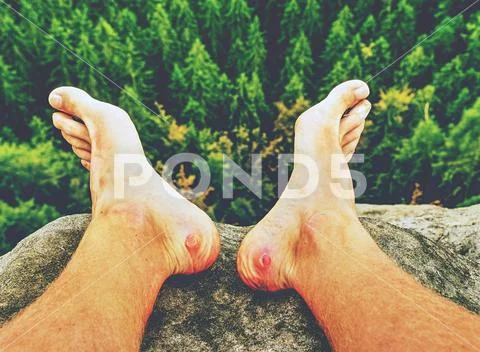 Couple hurt and tired legs resting on the top of the mountain Stock Photos