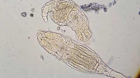 Couple of microorganisms under microscope Stock Footage 87818153